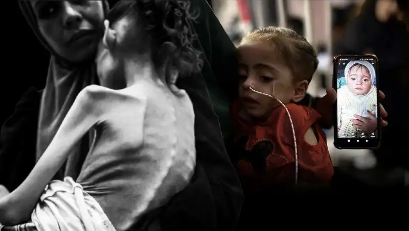 25 Kilodan 10 Kiloya Düştü: Küçük Meryem Açlıkla Mücadele Ediyor